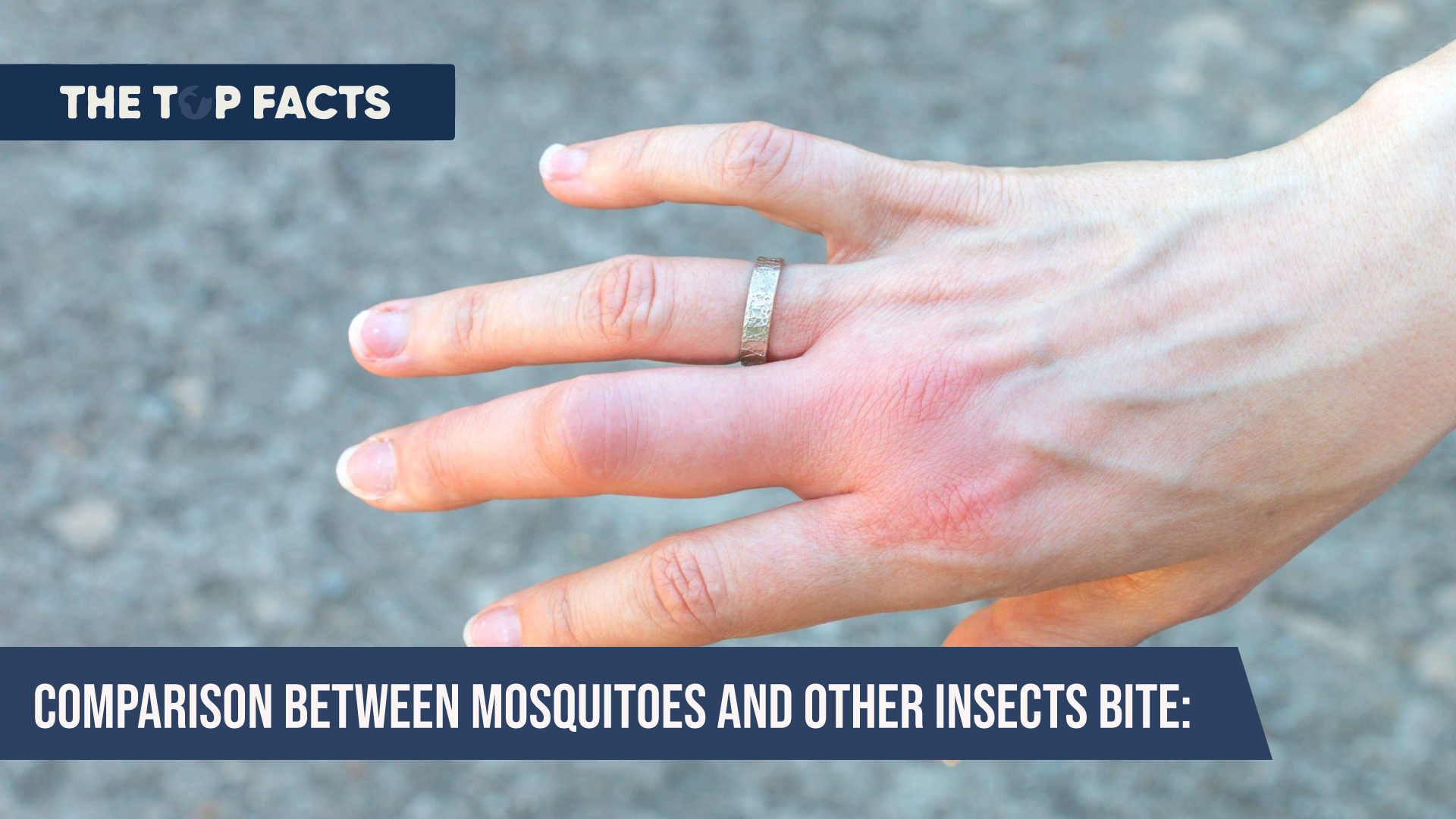 Comparison between mosquitoes and other insects bite