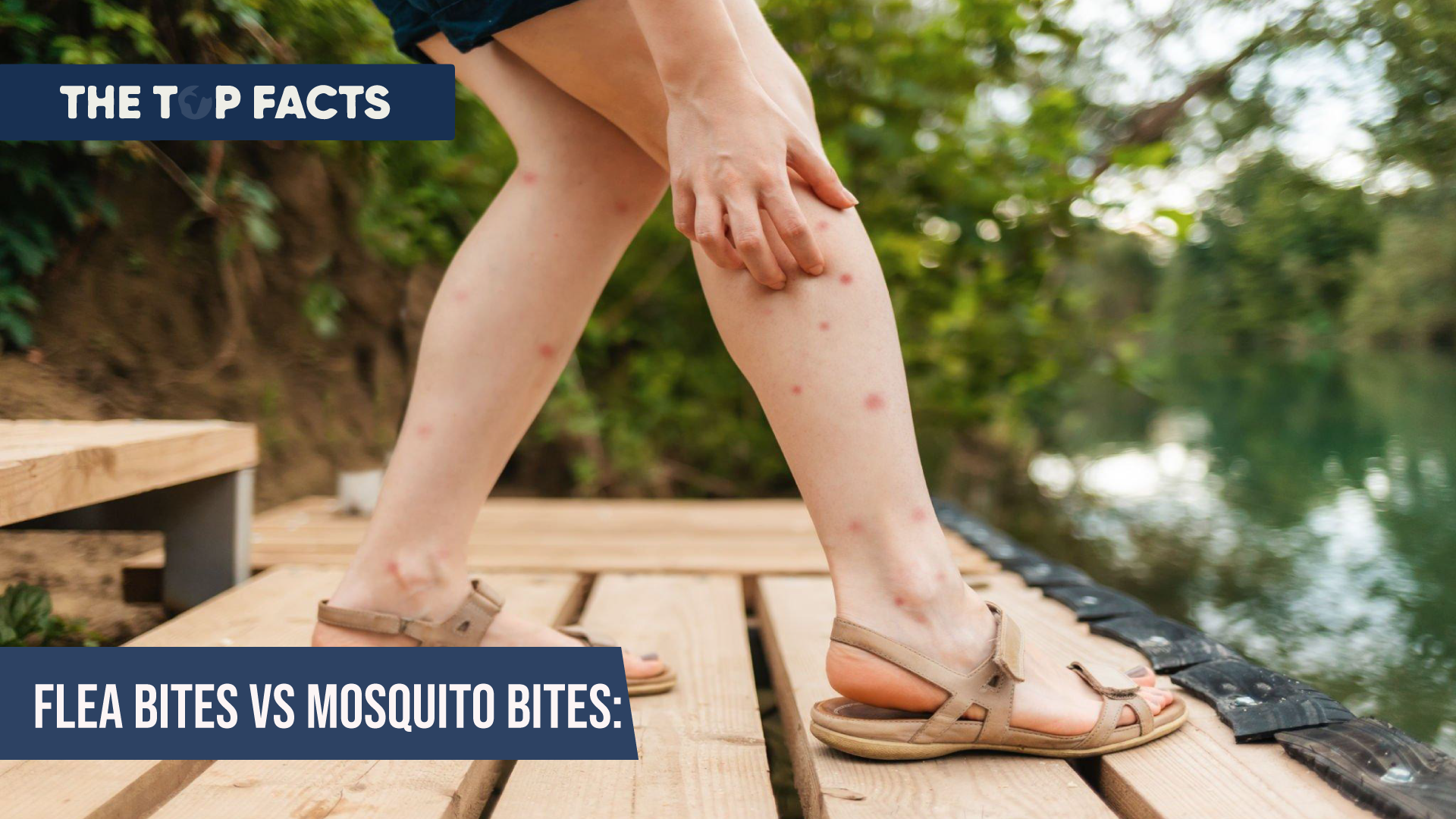 Flea bites vs mosquito bites